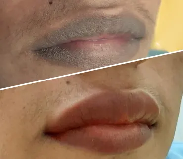 Neutralización del tono labial